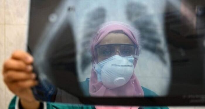 In Egitto medici in rivolta: abbandonati dallo Stato e Sisi li accusa di essere Fratelli Musulmani