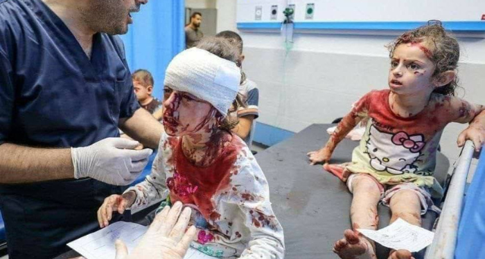 Orrore israeliano: ecco le immagini censurate dai media che i palestinesi vogliono che il mondo veda