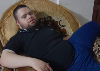 Gaza, incubo come Auschwitz: Palestinese con sindrome di Down sbranato dai cani israeliani e lasciato morire in agonia