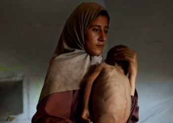 Gaza e la fame: quando il pane diventa un’arma