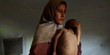 Gaza e la fame: quando il pane diventa un’arma