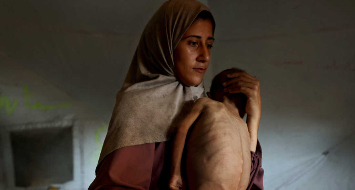 Gaza e la fame: quando il pane diventa un’arma